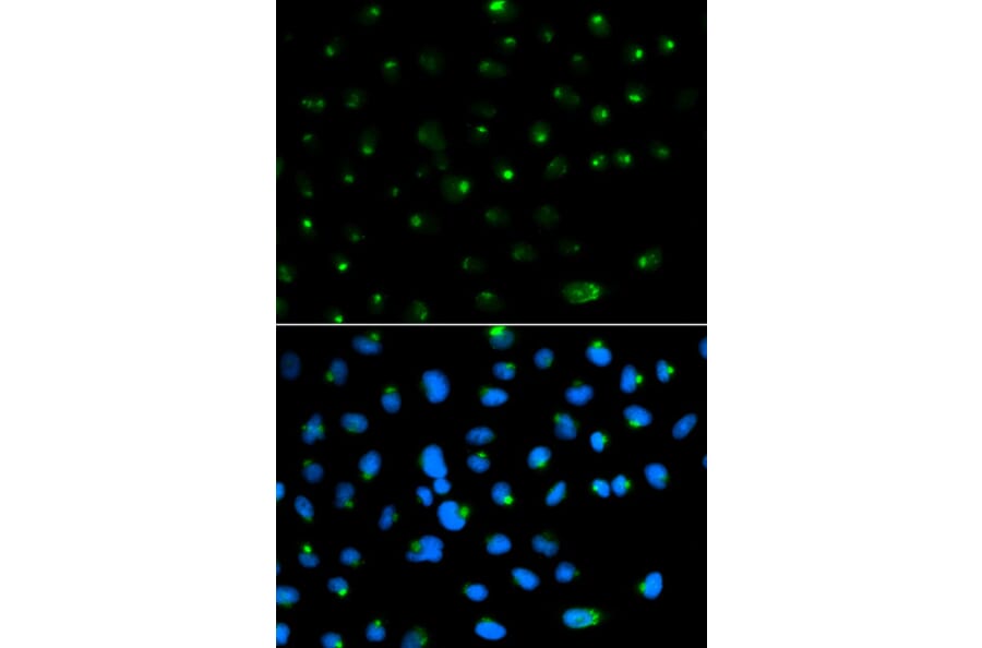 Immunofluorescence - PSAP Antibody from Signalway Antibody (32449) - Antibodies.com