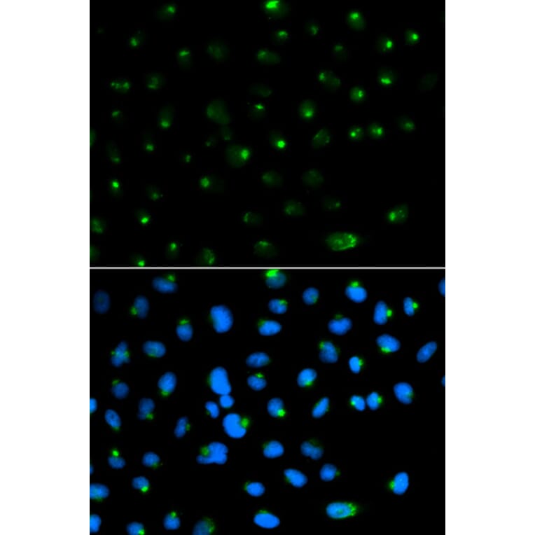 Immunofluorescence - PSAP Antibody from Signalway Antibody (32449) - Antibodies.com