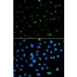 Immunofluorescence - PSAP Antibody from Signalway Antibody (32449) - Antibodies.com