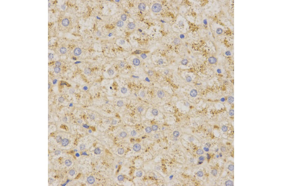 Immunohistochemistry - PSAP Antibody from Signalway Antibody (32449) - Antibodies.com