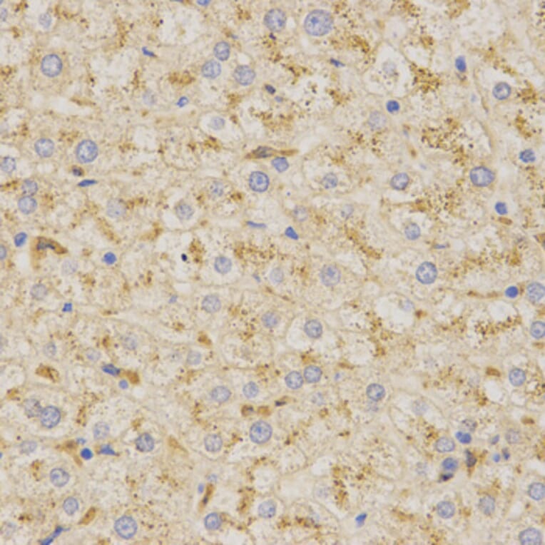 Immunohistochemistry - PSAP Antibody from Signalway Antibody (32449) - Antibodies.com