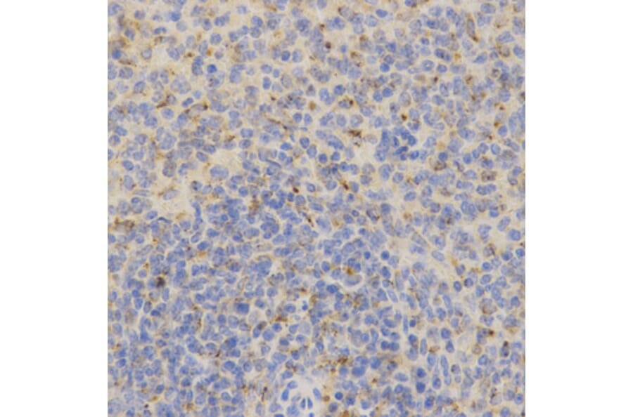 Immunohistochemistry - PSAP Antibody from Signalway Antibody (32449) - Antibodies.com