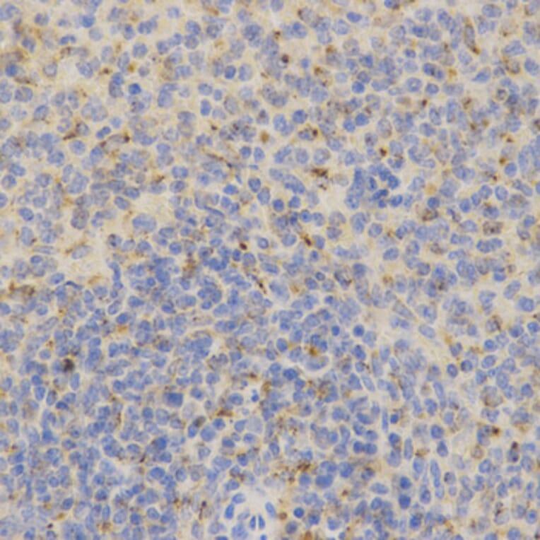 Immunohistochemistry - PSAP Antibody from Signalway Antibody (32449) - Antibodies.com