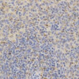 Immunohistochemistry - PSAP Antibody from Signalway Antibody (32449) - Antibodies.com