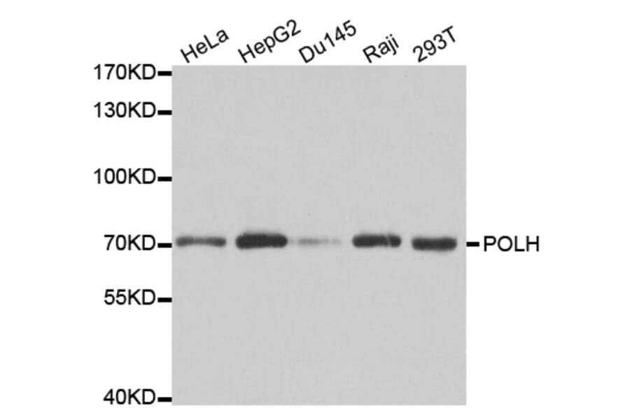 Western blot - POLH Antibody from Signalway Antibody (32458) - Antibodies.com