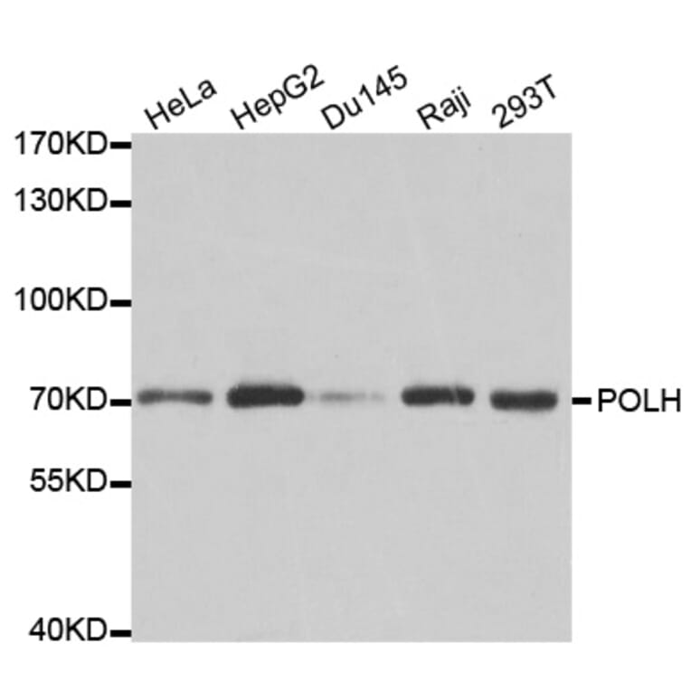 Western blot - POLH Antibody from Signalway Antibody (32458) - Antibodies.com