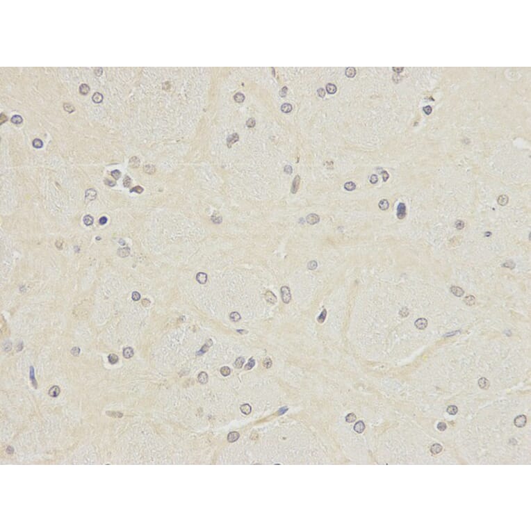Immunohistochemistry - POLH Antibody from Signalway Antibody (32458) - Antibodies.com