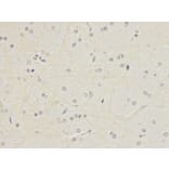 Immunohistochemistry - POLH Antibody from Signalway Antibody (32458) - Antibodies.com