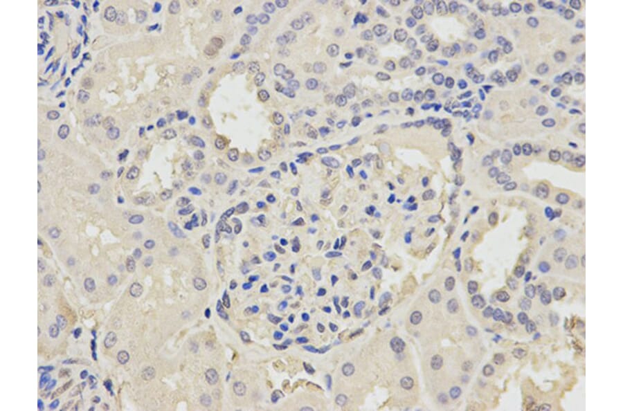 Immunohistochemistry - POLH Antibody from Signalway Antibody (32458) - Antibodies.com