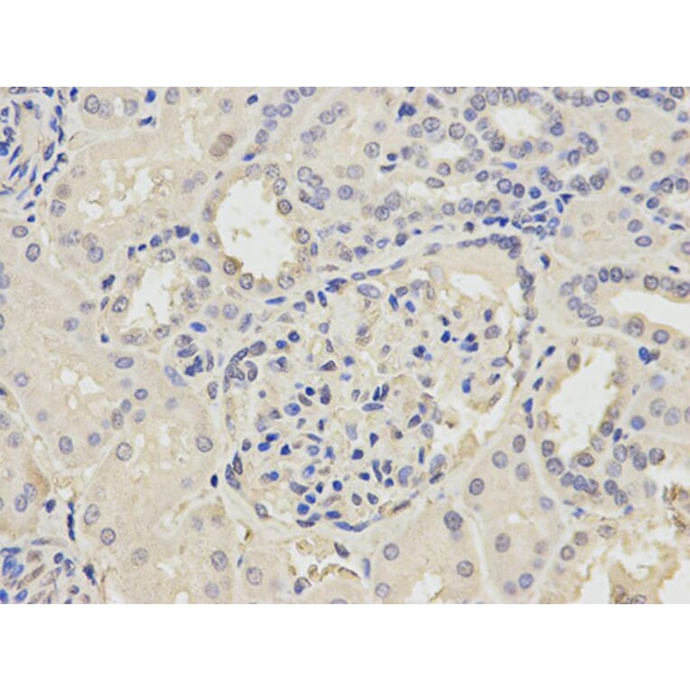 Immunohistochemistry - POLH Antibody from Signalway Antibody (32458) - Antibodies.com