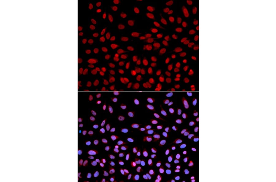 Immunofluorescence - POLH Antibody from Signalway Antibody (32458) - Antibodies.com