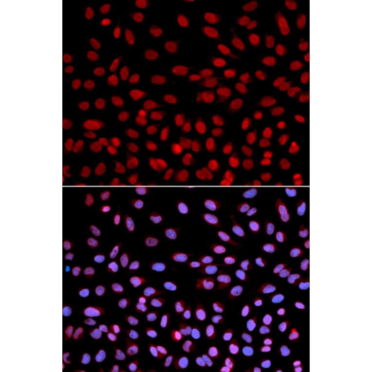 Immunofluorescence - POLH Antibody from Signalway Antibody (32458) - Antibodies.com