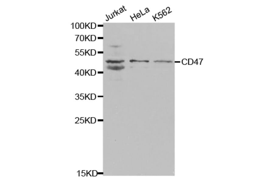 Western blot - CD47 Antibody from Signalway Antibody (32461) - Antibodies.com