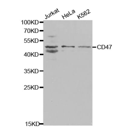 Western blot - CD47 Antibody from Signalway Antibody (32461) - Antibodies.com
