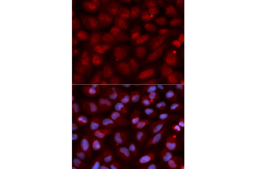 Immunofluorescence - CD47 Antibody from Signalway Antibody (32461) - Antibodies.com