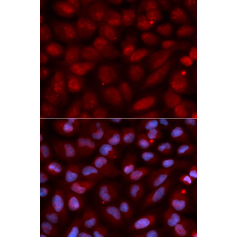 Immunofluorescence - CD47 Antibody from Signalway Antibody (32461) - Antibodies.com