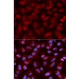 Immunofluorescence - CD47 Antibody from Signalway Antibody (32461) - Antibodies.com