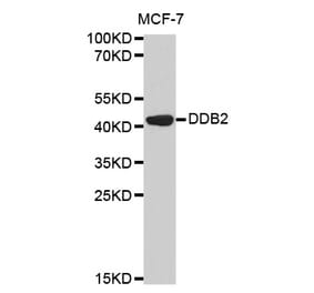 Western blot - DDB2 Antibody from Signalway Antibody (32469) - Antibodies.com
