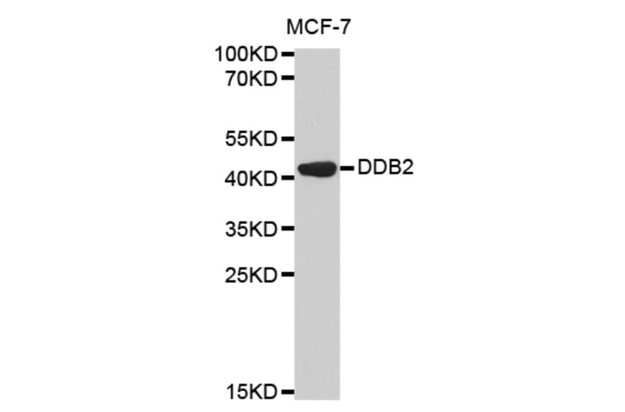 Western blot - DDB2 Antibody from Signalway Antibody (32469) - Antibodies.com