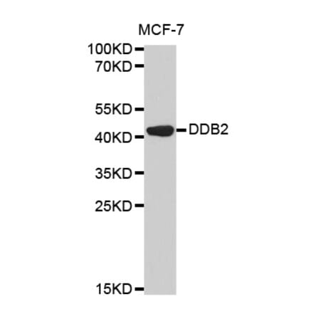 Western blot - DDB2 Antibody from Signalway Antibody (32469) - Antibodies.com