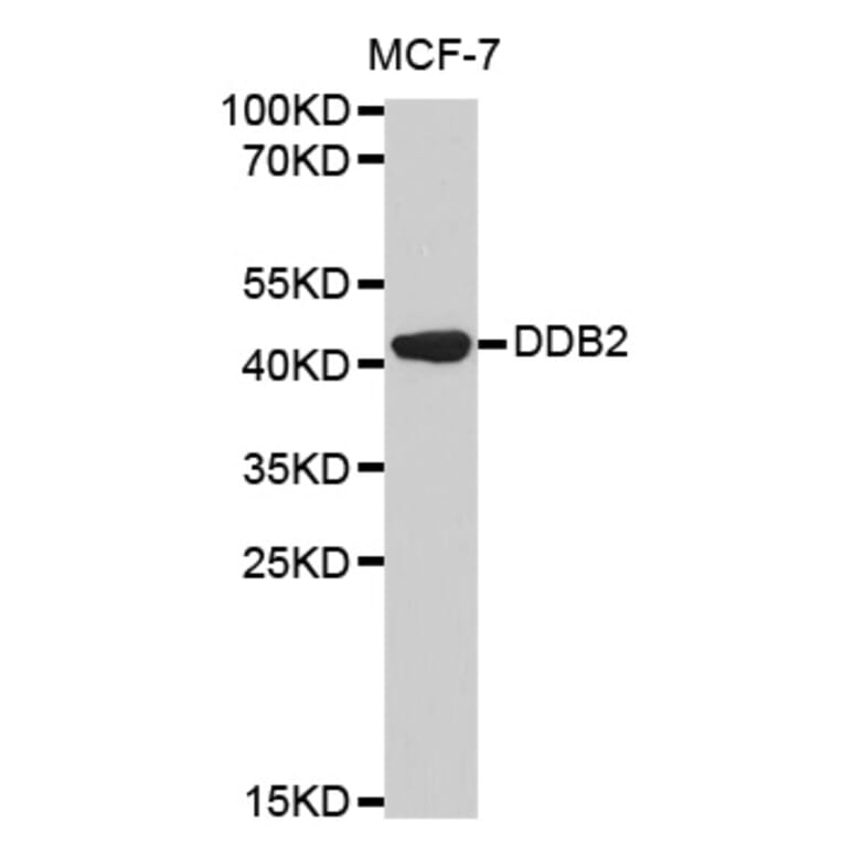 Western blot - DDB2 Antibody from Signalway Antibody (32469) - Antibodies.com