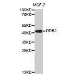 Western blot - DDB2 Antibody from Signalway Antibody (32469) - Antibodies.com