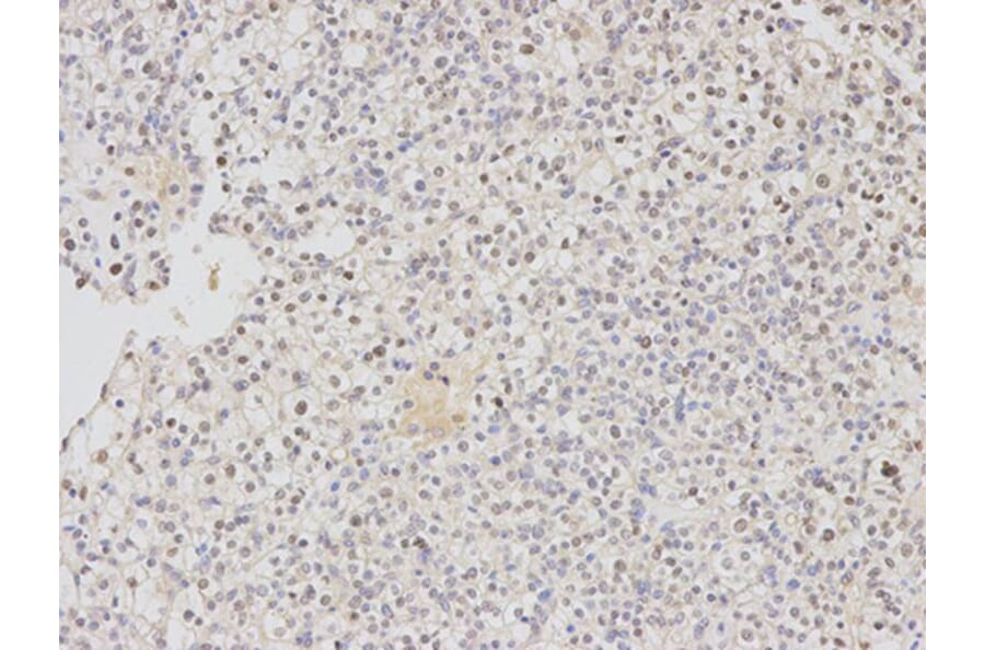 Immunohistochemistry - DDB2 Antibody from Signalway Antibody (32469) - Antibodies.com