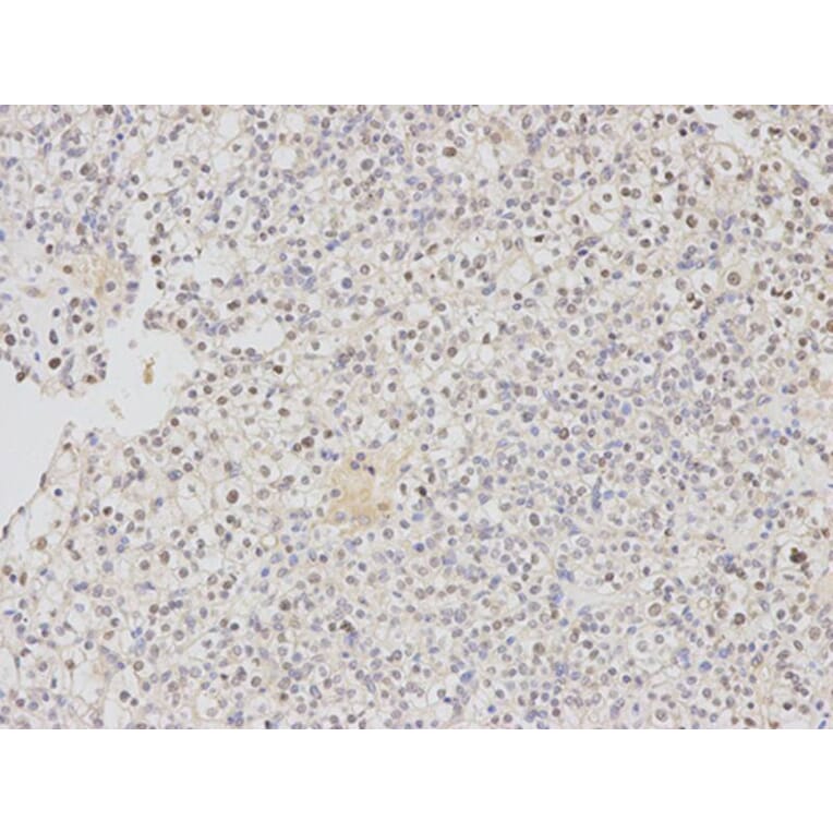 Immunohistochemistry - DDB2 Antibody from Signalway Antibody (32469) - Antibodies.com