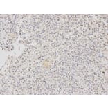 Immunohistochemistry - DDB2 Antibody from Signalway Antibody (32469) - Antibodies.com
