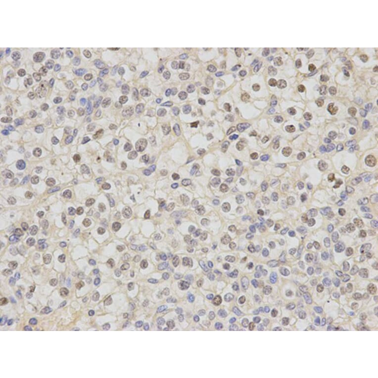 Immunohistochemistry - DDB2 Antibody from Signalway Antibody (32469) - Antibodies.com