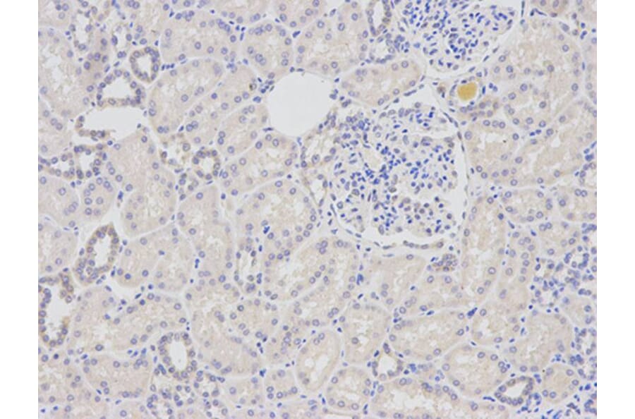 Immunohistochemistry - DDB2 Antibody from Signalway Antibody (32469) - Antibodies.com