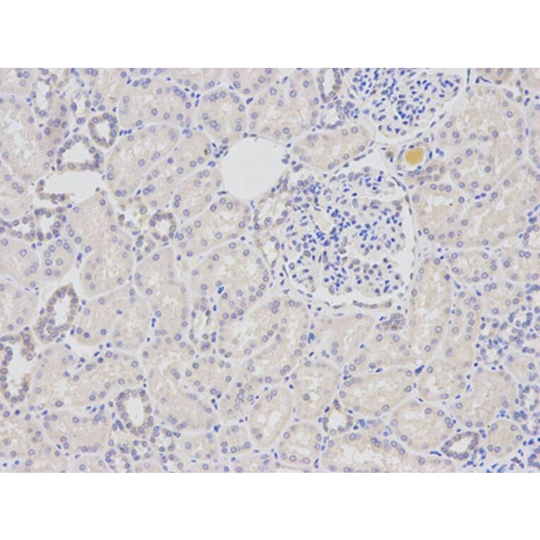 Immunohistochemistry - DDB2 Antibody from Signalway Antibody (32469) - Antibodies.com