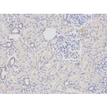 Immunohistochemistry - DDB2 Antibody from Signalway Antibody (32469) - Antibodies.com