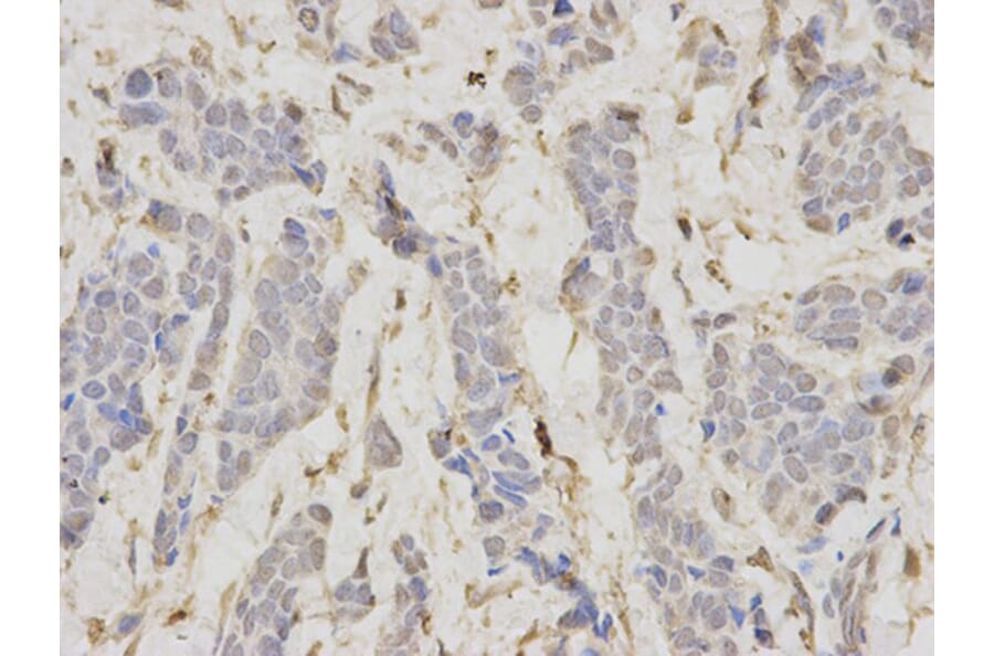 Immunohistochemistry - LIG1 Antibody from Signalway Antibody (32474) - Antibodies.com