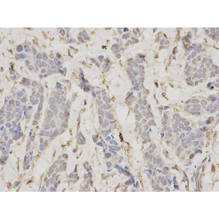 Immunohistochemistry - LIG1 Antibody from Signalway Antibody (32474) - Antibodies.com
