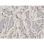 Immunohistochemistry - LIG1 Antibody from Signalway Antibody (32474) - Antibodies.com