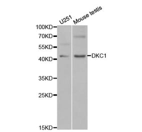 Western blot - DKC1 Antibody from Signalway Antibody (32477) - Antibodies.com