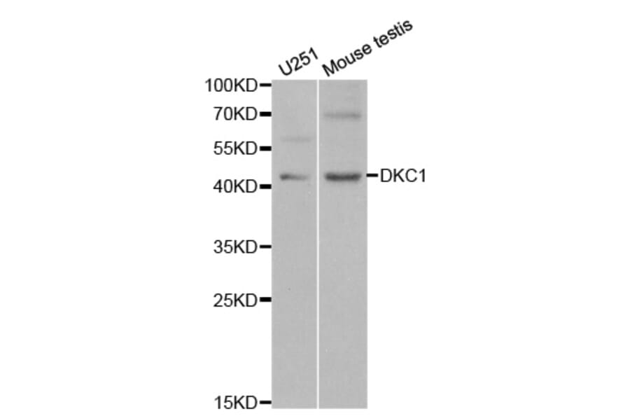 Western blot - DKC1 Antibody from Signalway Antibody (32477) - Antibodies.com