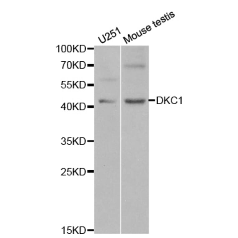 Western blot - DKC1 Antibody from Signalway Antibody (32477) - Antibodies.com