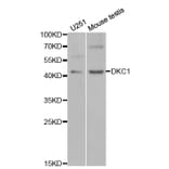 Western blot - DKC1 Antibody from Signalway Antibody (32477) - Antibodies.com