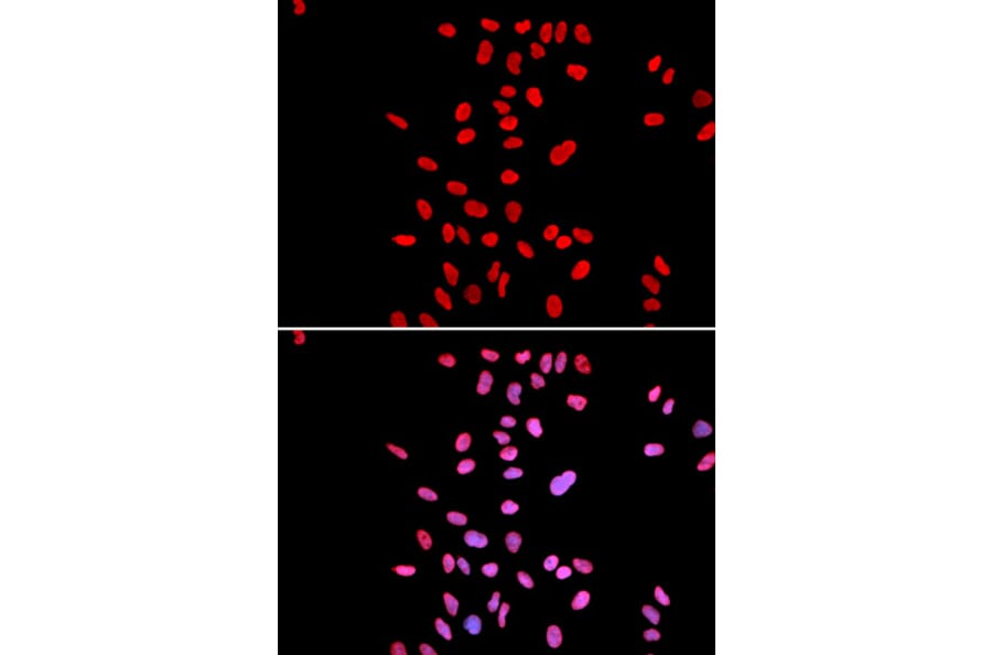 Immunofluorescence - DKC1 Antibody from Signalway Antibody (32477) - Antibodies.com