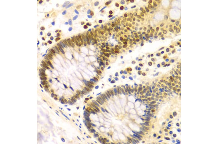 Immunohistochemistry - DKC1 Antibody from Signalway Antibody (32477) - Antibodies.com