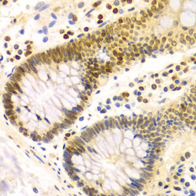 Immunohistochemistry - DKC1 Antibody from Signalway Antibody (32477) - Antibodies.com