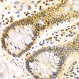 Immunohistochemistry - DKC1 Antibody from Signalway Antibody (32477) - Antibodies.com