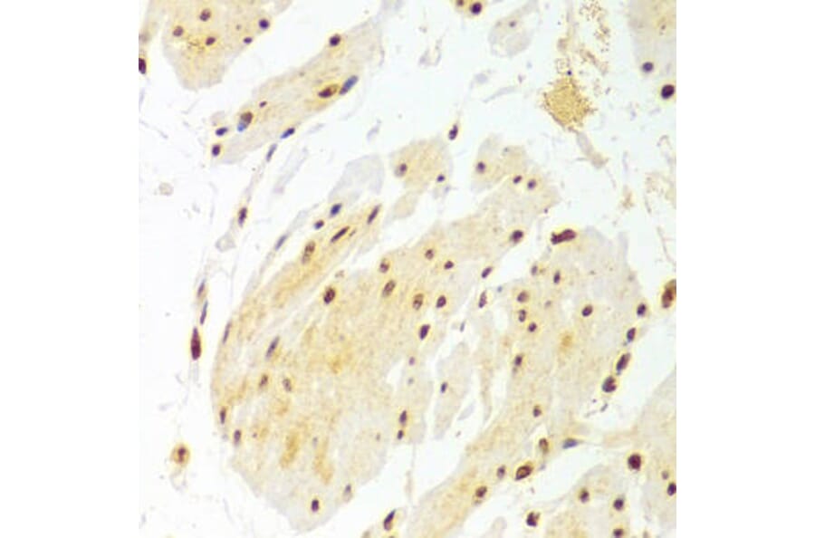 Immunohistochemistry - DKC1 Antibody from Signalway Antibody (32477) - Antibodies.com