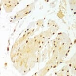 Immunohistochemistry - DKC1 Antibody from Signalway Antibody (32477) - Antibodies.com