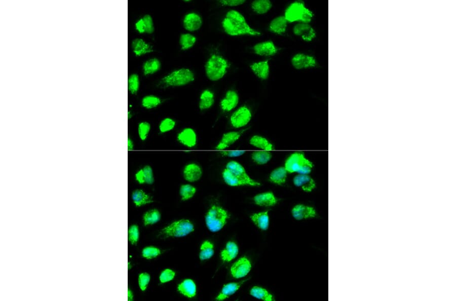 Immunofluorescence - LIG3 Antibody from Signalway Antibody (32487) - Antibodies.com