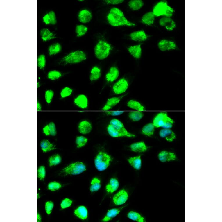 Immunofluorescence - LIG3 Antibody from Signalway Antibody (32487) - Antibodies.com