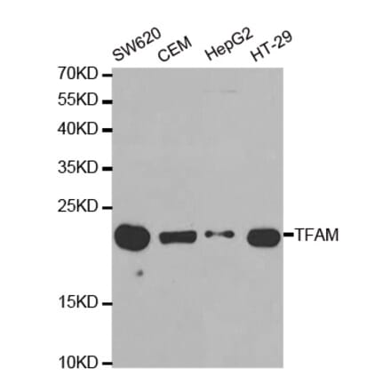 Western blot - TFAM Antibody from Signalway Antibody (32501) - Antibodies.com