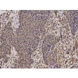Immunohistochemistry - TFAM Antibody from Signalway Antibody (32501) - Antibodies.com